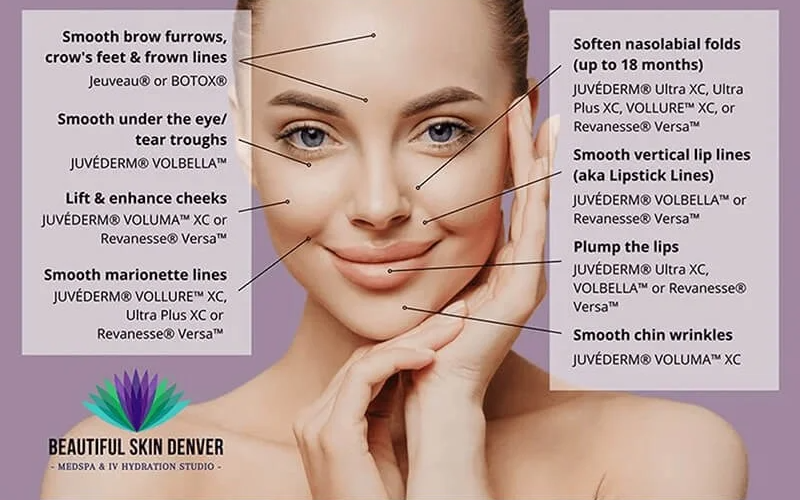 Benefits of Neurotoxins